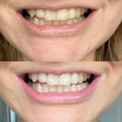 PAP+ Teeth Whitening Powder