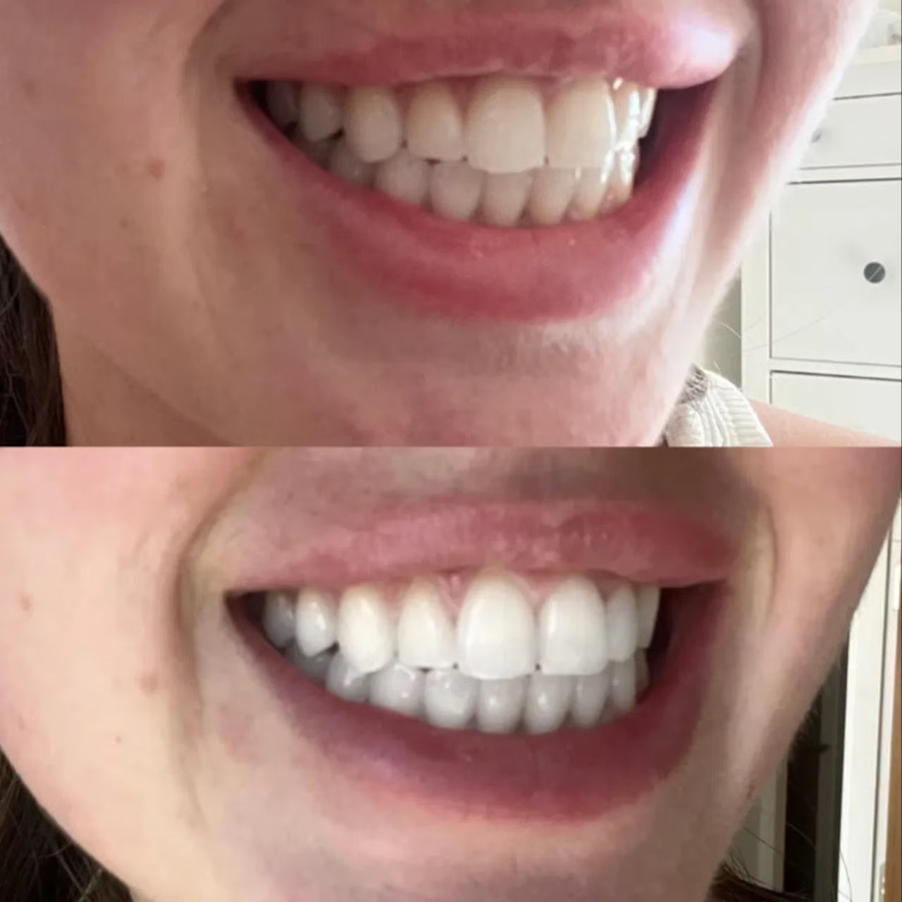 PAP+ Teeth Whitening Powder
