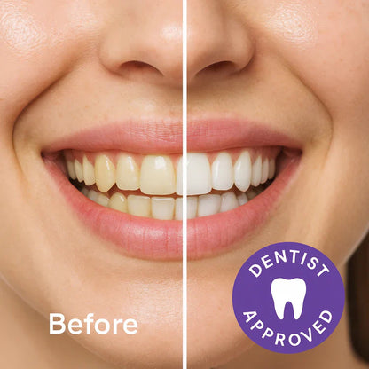 PAP+ Teeth Whitening Powder